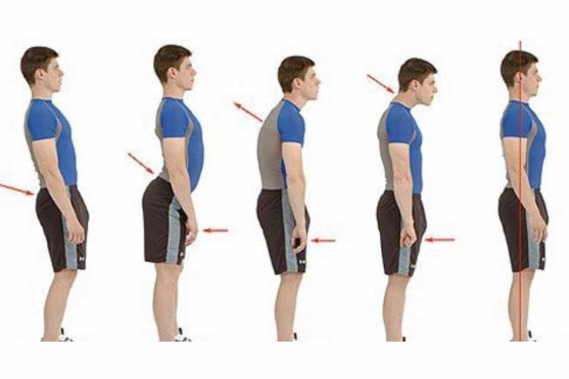 Your Ultimate Guide to Posture Management